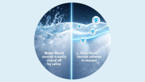 Water-based varnish is easily rinsed off by saliva while FluoroDose varnish adheres to enamel