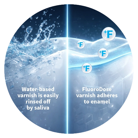 Split visual: water-based varnish rinsed off by saliva versus FluoroDose adhering to enamel