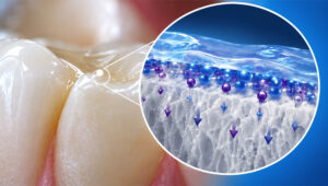 Graphic illustrating fluoride varnish adhering to teeth